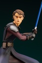 (PO) ARTFX+ Star Wars: The Clone Wars - Anakin Skywalker The Clone Wars Ver. Image_11